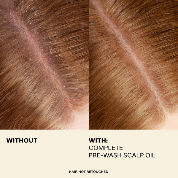 JVN Treatment Complete Pre-Wash Scalp Oil JVN Pre-Wash Scalp Oil | Rosemary-Infused Scalp Treatment sulfate-free silicone-free sustainable